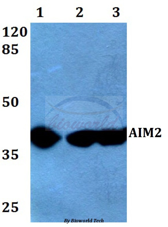 Western blot (WB) analysis of AIM2 (A78) pAb at 1:500 dilution Lane1:HEK293T whole cell lysate Lane2:Raw264.7 whole cell lysate Lane3:H9C2 whole cell lysate