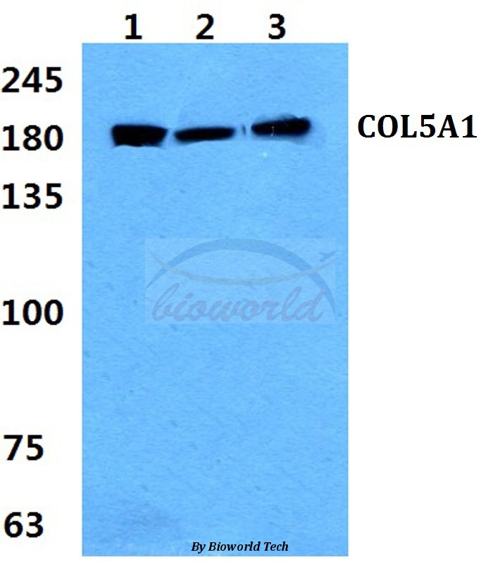 Western blot (WB) analysis of COL5A1 (E325) pAb at 1:500 dilution Lane1:Jurkat cell lysate Lane2:Mouse liver tissue lysate Lane3:Rat liver tissue lysate