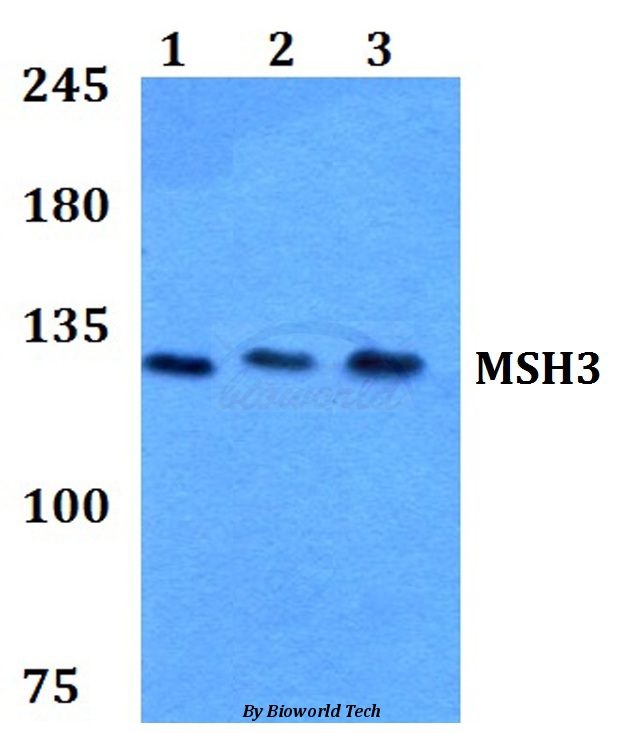 Western blot (WB) analysis of MSH3 (A80) pAb at 1:500 dilution Lane1:HEK293T whole cell lysate Lane2:sp2/0 whole cell lysate Lane3:H9C2 whole cell lysate