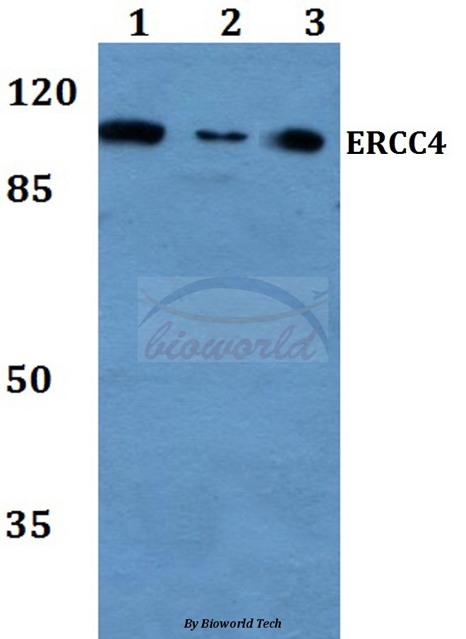 Western blot (WB) analysis of ERCC4 (A822)pAb at 1:500 dilution Lane1:HEK293T whole cell lysate Lane2:sp2/0 whole cell lysate Lane3:PC12 whole cell lysate