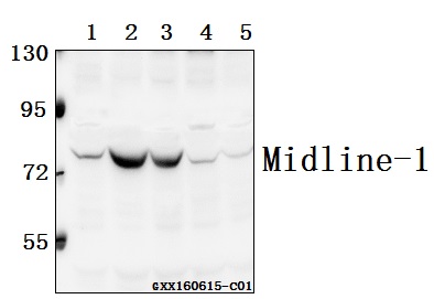 Western blot (WB) analysis of Midline-1 (E103) pAb at 1:500 dilution Lane1:A549 whole cell lysate(40ug) Lane2:HEK293T whole cell lysate(40ug) Lane3:786-O whole cell lysate(40ug) Lane4:L02 whole cell lysate(40ug) Lane5:HepG2 whole cell lysate(40ug)