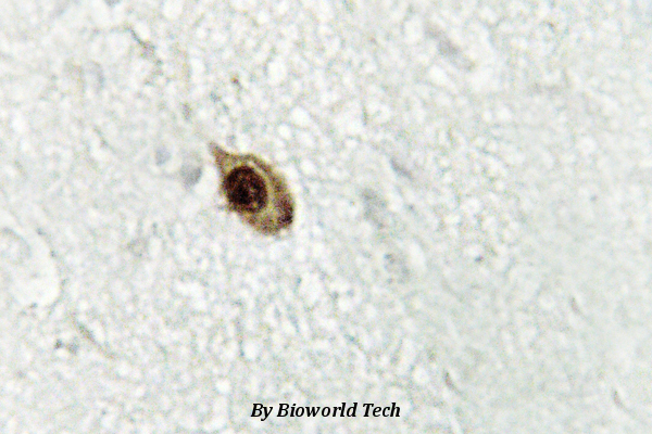 Immunohistochemistry (IHC) analyzes of Zic1/2/3 (D348) pAb in paraffin-embedded human brain tissue.