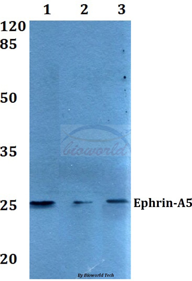 Western blot (WB) analysis of Ephrin-A5 (P63) pAb at 1:500 dilution Lane1:A549 whole cell lysate Lane2:Raw264.7 whole cell lysate Lane3:Rat lung tissue lysate