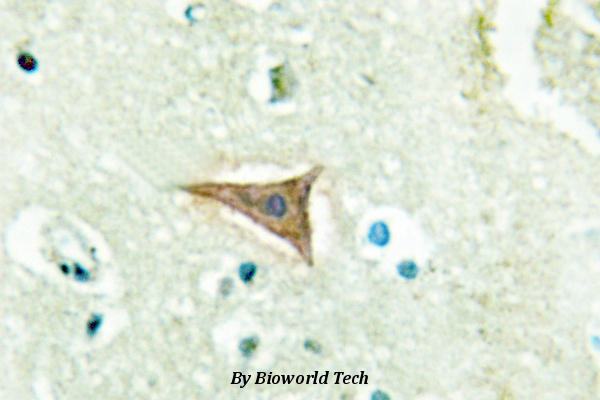 Immunohistochemistry (IHC) analyzes of Ephrin-A5 (P63) pAb in paraffin-embedded human brain tissue.