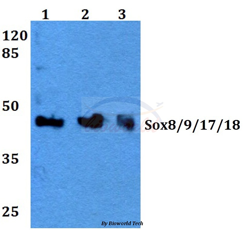 Western blot (WB) analysis of Sox8/9/17/18 (K148) pAb at 1:500 dilution Lane1:HEK293A whole cell lysate Lane2:Raw264.7 whole cell lysate Lane3:PC12 whole cell lysate