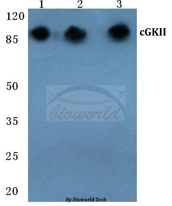 Western blot (WB) analysis of cGKII (D412) pAb at 1:500 dilution Lane1:A549 cell lysate Lane2:Mouse brain tissue lysate Lane3:Rat liver tissue lysate