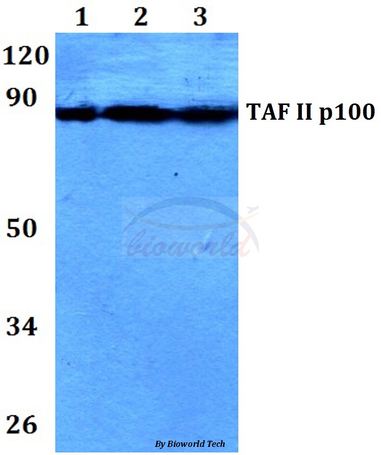 Western blot (WB) analysis of TAF II p100 (G411) pAb at 1:500 dilution Lane1:HEK293T whole cell lysate Lane2:Raw264.7 whole cell lysate Lane3:H9C2 whole cell lysate