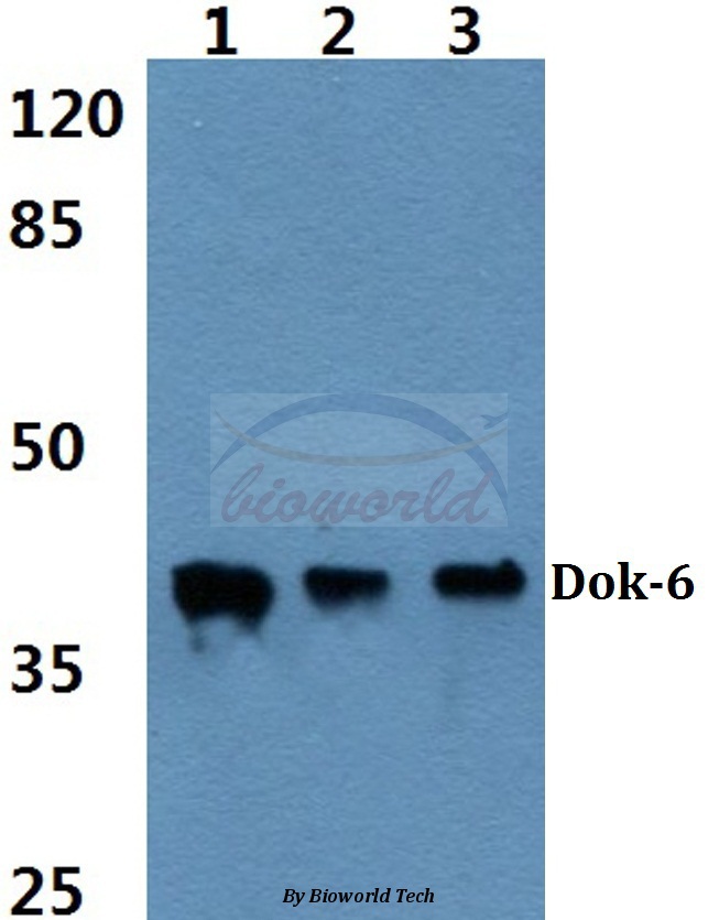 Western blot (WB) analysis of Dok-6 (G130) pAb at 1:500 dilution Lane1:A549 cell lysate Lane2:sp2/0 cell lysate Lane3:H9C2 cell lysate