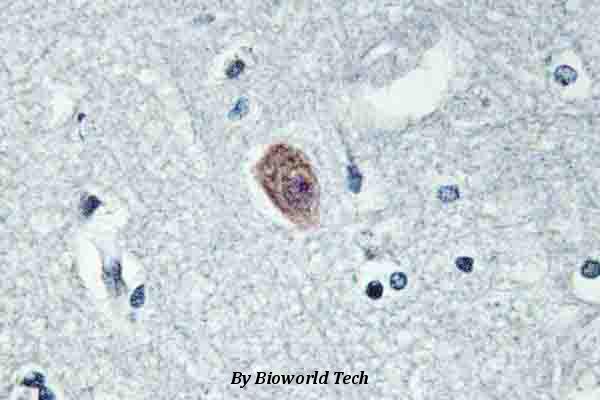 Immunohistochemistry (IHC) analyzes of Dok-6 (G130) pAb in paraffin-embedded human brain tissue.