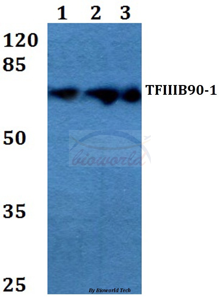 Western blot (WB) analysis of TFIIIB90-1 (E257) pAb at 1:500 dilution Lane1:Hela whole cell lysate Lane2:Raw264.7 whole cell lysate Lane3:PC12 whole cell lysate