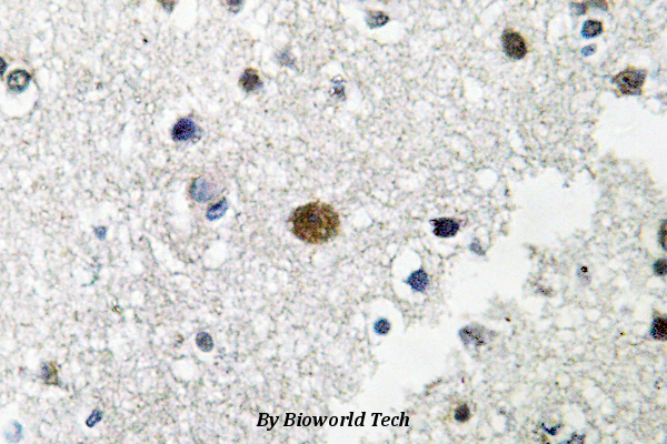 Immunohistochemistry (IHC) analyzes of TFIIIB90-1 (E257) pAb in paraffin-embedded human brain tissue.