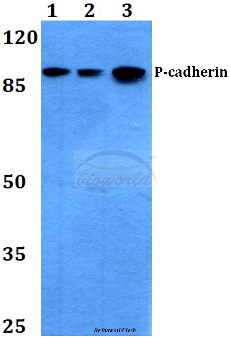 Western blot (WB) analysis of P-Cadherin (G78) pAb at 1:500 dilution Lane1:HEK293T whole cell lysate Lane2:Raw264.7 whole cell lysate Lane3:H9C2 whole cell lysate