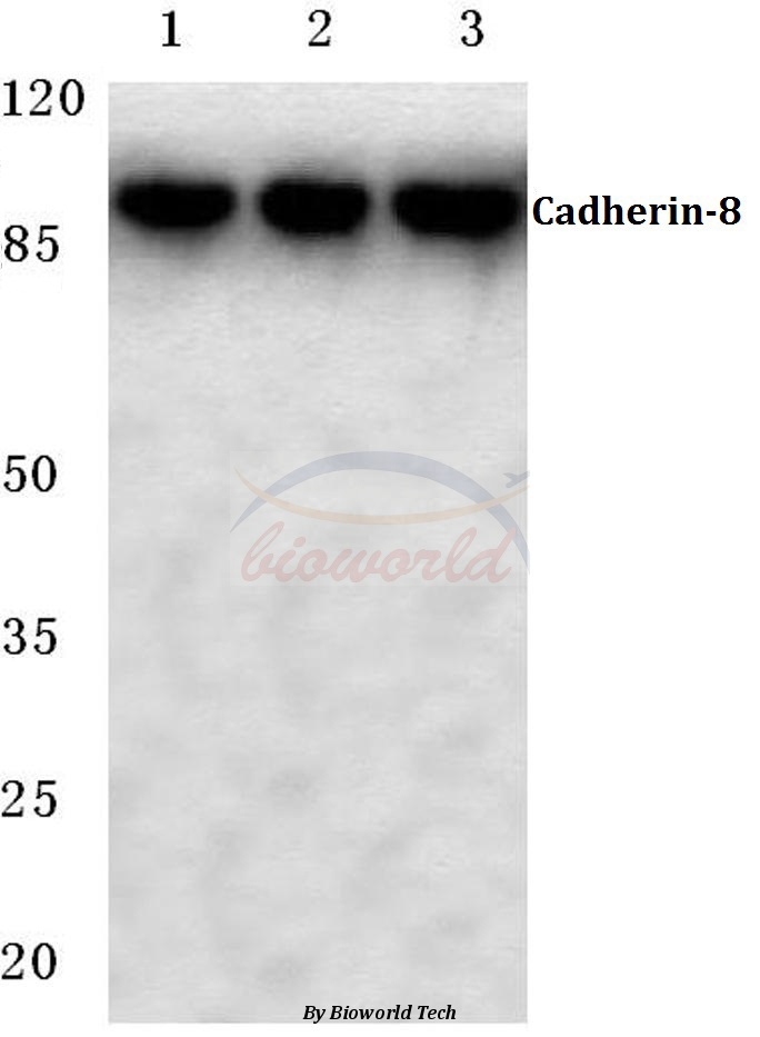 Western blot (WB) analysis of Cadherin-8 (A519) pAb at 1:500 dilution Lane1:Hela cell lysate Lane2:Mouse liver tissue lysate Lane3:Rat liver tissue lysate