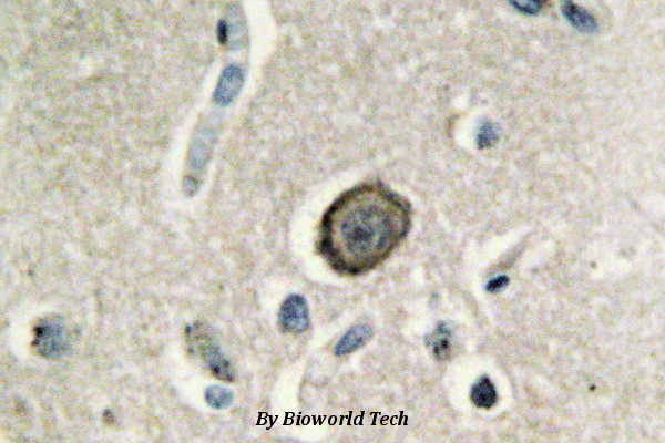Immunohistochemistry (IHC) analyzes of Cadherin-8 (A519) pAb in paraffin-embedded human brain tissue.