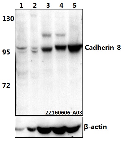 Western blot (WB) analysis of Cadherin-8 (A519) pAb at 1:500 dilution Lane1:HEK293T whole cell lysate(40ug) Lane2:U-87MG whole cell lysate(40ug) Lane3:The brain tissue lysate of Fetal Mouse(40ug) Lane4:The brain tissue lysate of Fetal Rat(40ug) Lane5:C6 w