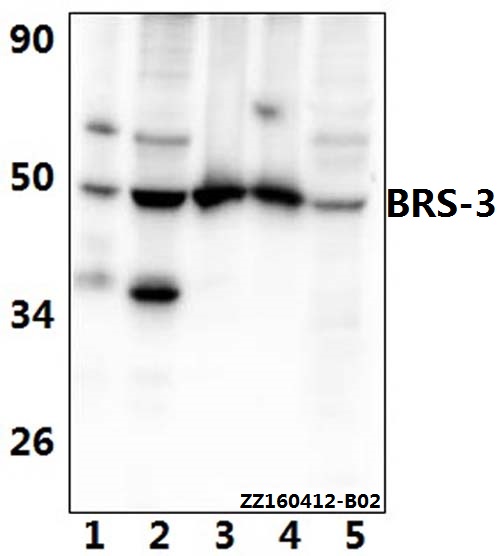 Western blot (WB) analysis of BRS-3 (E201) pAb at 1:500 dilution Lane1:Jurkat whole cell lysate(40ug) Lane2:A549 whole cell lysate(40ug) Lane3:The testis tissue lysate of Mouse(40ug) Lane4:The testis tissue lysate of Rat(40ug) Lane5:HEK293T whole cell lys