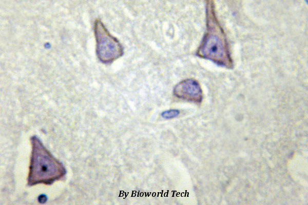 Immunohistochemistry (IHC) analyzes of Kir6.2 (V220) pAb in paraffin-embedded human brain tissue.