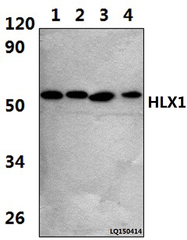 Western blot (WB) analysis of HLX1 (Q338) pAb at 1:1000 dilution Lane1:JURKAT whole cell lysate(37ug) Lane2:THP-1 whole cell lysate(37ug) Lane3:The peripheral blood cell lysate of Rat(36ug) Lane4:The peripheral blood cell lysate of Mouse(36ug)