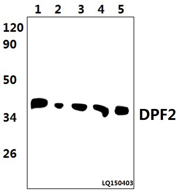 Western blot (WB) analysis of DPF2 (E174) pAb at 1:1000 dilution Lane1:THP-1 whole cell lysate(37ug) Lane2:MCF-7 whole cell lysate(48ug) Lane3:RAW264.7 whole cell lysate(57ug) Lane4:NIH3T3 whole cell lysate(48ug) Lane5:H9C2 whole cell lysate(37ug)