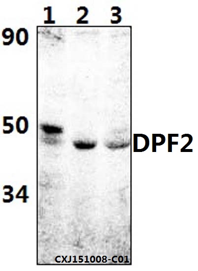 Western blot (WB) analysis of DPF2 (E174) pAb at 1:500 dilution Lane1:HEK293T whole cell lysate(20ug) Lane2:RAW264.7 whole cell lysate(20ug) Lane3:H9C2 whole cell lysate(20ug)