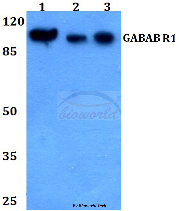Western blot (WB) analysis of GABAB R1 (P931) pAb at 1:500 dilution Lane1:Hela whole cell lysate Lane2:sp2/0 whole cell lysate Lane3:PC12 whole cell lysate