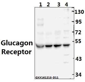 Western blot (WB) analysis of Glucagon Receptor (K136) pAb at 1:500 dilution Lane1:AML-12 whole cell lysate(40ug) Lane2:H9C2 whole cell lysate(40ug) Lane3:A549 whole cell lysate(40ug) Lane4:HEK293T whole cell lysate(40ug)