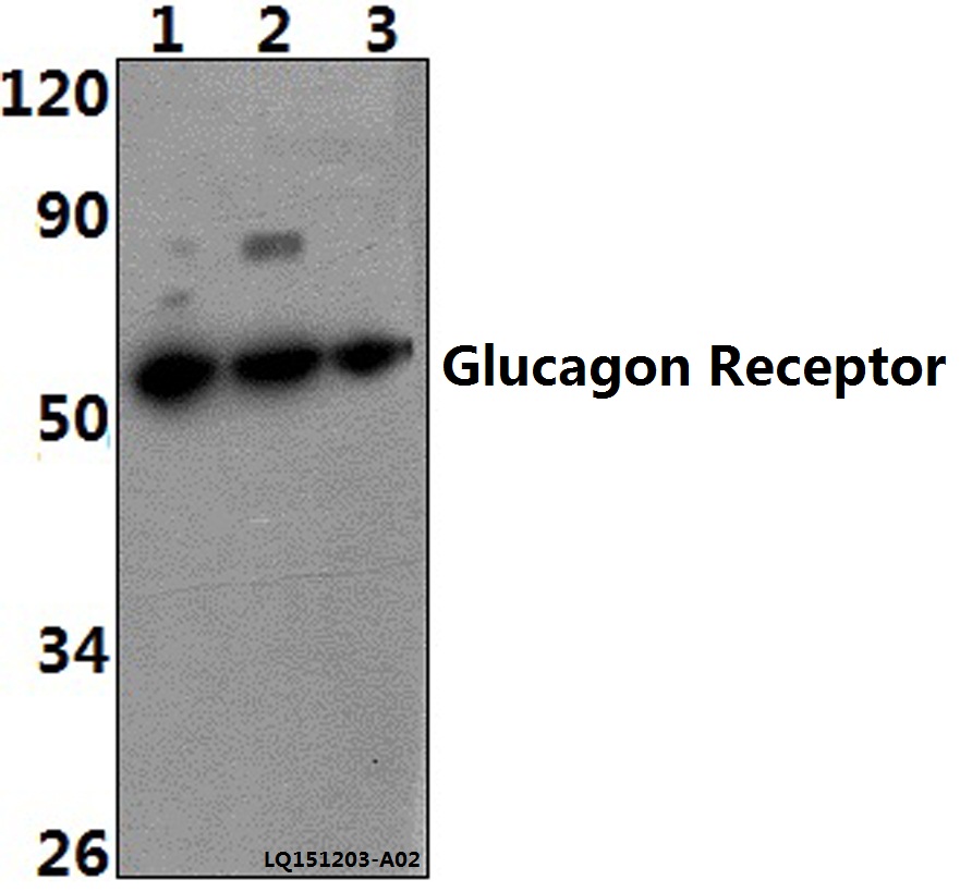 Western blot (WB) analysis of Glucagon Receptor (K136) pAb at 1:1000 dilution Lane1:HEK293T whole cell lysate(40ug) Lane2:H9C2 whole cell lysate(40ug) Lane3:SP2/0 whole cell lysate(40ug)