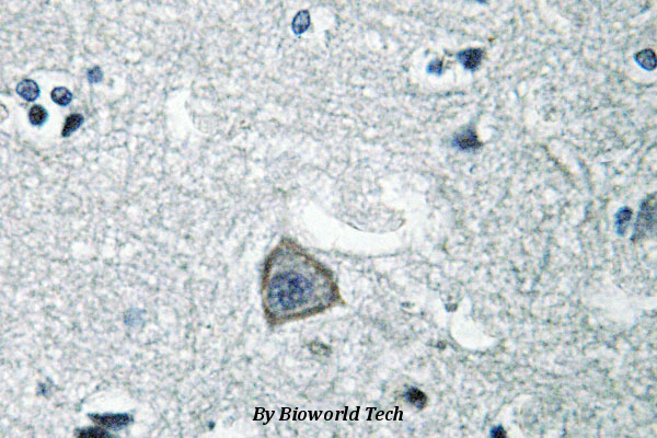 Immunohistochemistry (IHC) analyzes of SR-2C (Q437) pAb in human paraffin-embedded brain tissue.