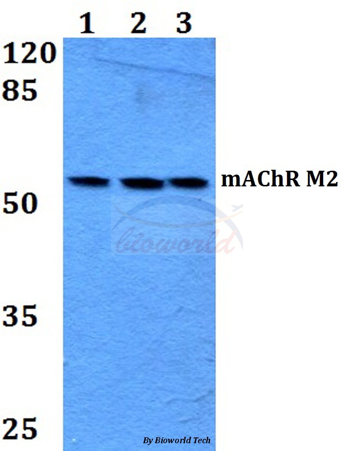 Western blot (WB) analysis of mAChR M2 (P224) pAb at 1:500 dilution Lane1:HEK293T whole cell lysate Lane2:Raw264.7 whole cell lysate Lane3:PC12 whole cell lysate