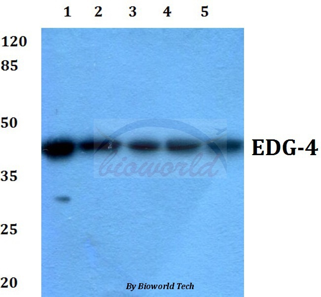 WesterWestern blot (WB) analysis of EDG-4 (L310) pAb at 1:500 dilution Lane1:Hela cell lysate Lane2:HEK293T cell lysate Lane3:sp2/0 cell lysate Lane4:H9C2 cell lysate Lane5:PC12 cell lysate