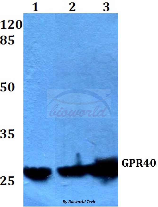 Western blot (WB) analysis of GPR40 (W224) pAb at 1:500 dilution Lane1:HEK293T whole cell lysate Lane2:Raw264.7 whole cell lysate Lane3:H9C2 whole cell lysate