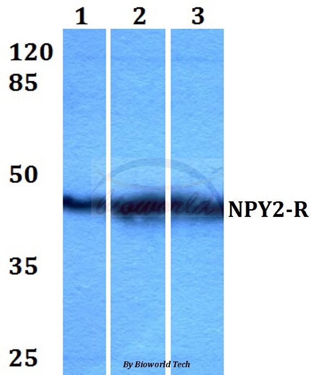 Western blot (WB) analysis of NPY2-R (D42) pAb at 1:500 dilution Lane1:HEK293T whole cell lysate Lane2:Raw264.7 whole cell lysate Lane3:PC12 whole cell lysate