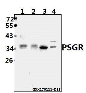 Western blot (WB) analysis of PSGR (F237) pAb at 1:500 dilution Lane1:PC3 whole cell lysate(40ug) Lane2:L02 whole cell lysate(40ug) Lane3:AML-12 whole cell lysate(40ug) Lane4:H9C2 whole cell lysate(40ug)