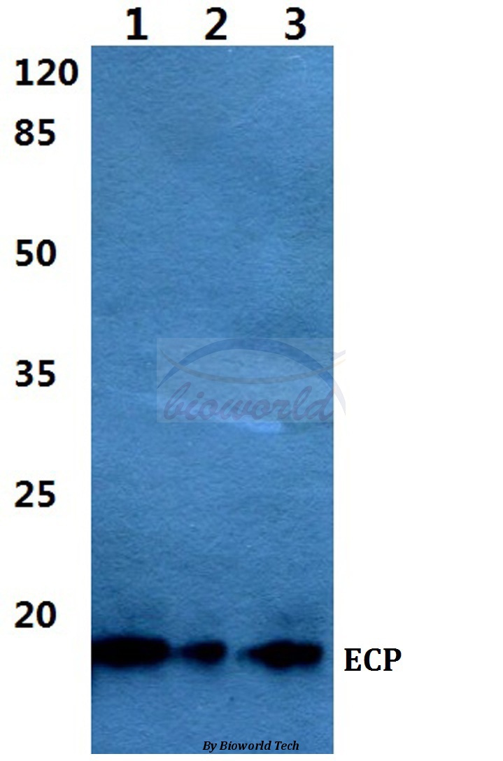 Western blot (WB) analysis of ECP (V151) pAb at 1:500 dilution Lane1:Jurkat cell lysate Lane2:sp2/0 cell lysate Lane3:PC12 cell lysate