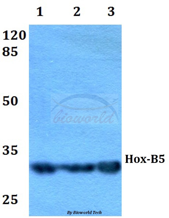 Western blot (WB) analysis of Hox-B5 (T199) pAb at 1:500 dilution Lane1:HEK293T whole cell lysate Lane2:Raw264.7 whole cell lysate Lane3:H9C2 whole cell lysate
