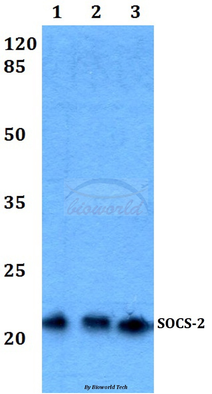 Western blot (WB) analysis of SOCS-2 (E67) pAb at 1:500 dilution Lane1:HEK293T whole cell lysate Lane2:Raw264.7 whole cell lysate Lane3:PC12 whole cell lysate