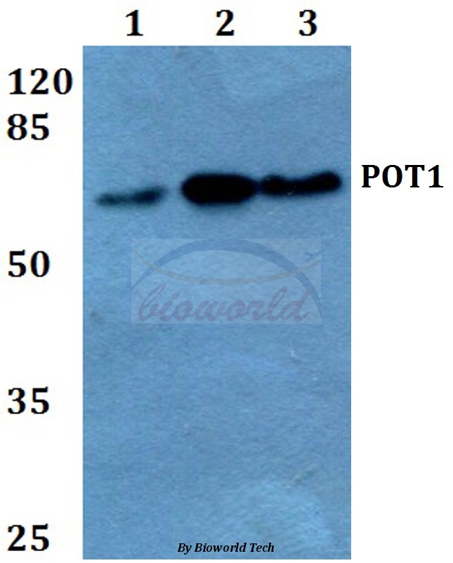 Western blot (WB) analysis of POT1 (N296) pAb at 1:500 dilution Lane1:Hela whole cell lysate Lane2:Raw264.7 whole cell lysate Lane3:H9C2 whole cell lysate