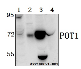 Western blot (WB) analysis of POT1 (N296) pAb at 1:500 dilution Lane1:786-O whole cell lysate(40ug) Lane2:PC3 whole cell lysate(40ug) Lane3:The Testis tissue lysate of Mouse(40ug) Lane4:The Testis tissue lysate of Rat(40ug)