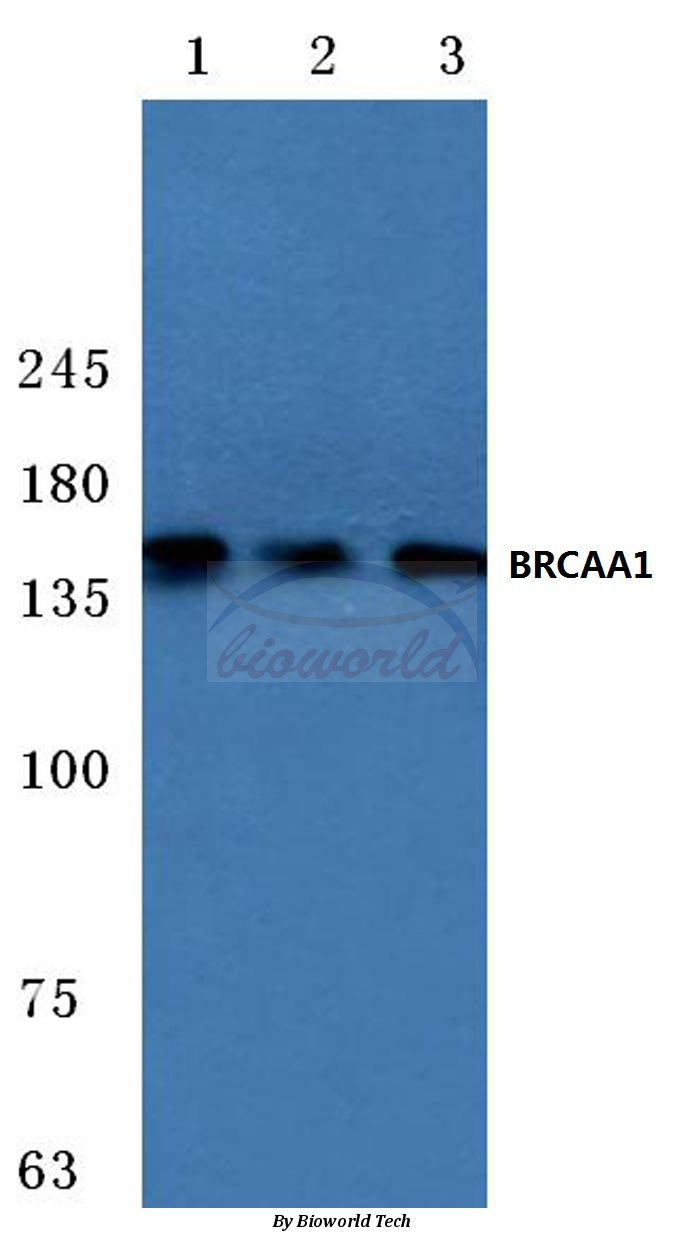 Western blot (WB) analysis of BRCAA1 (D810) pAb at 1:500 dilution Lane1:Hela cell lysate Lane2:MCF-7 cell lysate Lane3:Rat lung tissue lysate