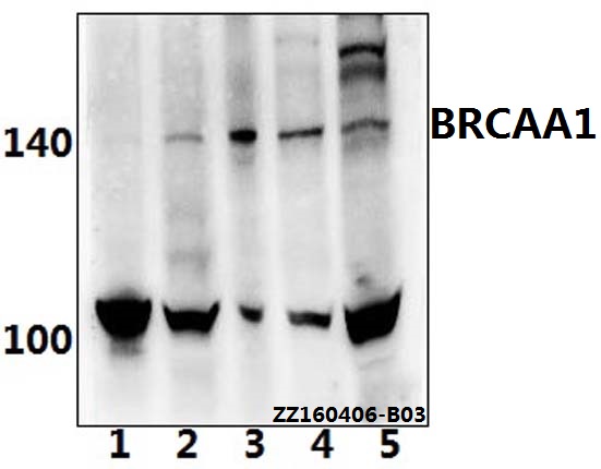 Western blot (WB) analysis of BRCAA1 (D810) pAb at 1:500 dilution Lane1:Hela whole cell lysate(40ug) Lane2:MCF-7 whole cell lysate(40ug) Lane3:Jurkat whole cell lysate(40ug) Lane4:AML-12 whole cell lysate(40ug) Lane5:PC12 whole cell lysate(40ug)