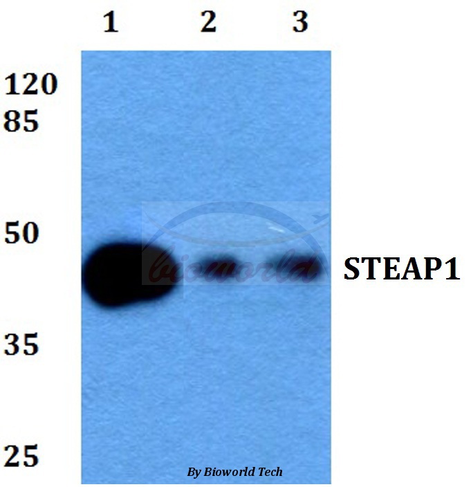 Western blot (WB) analysis of STEAP1 (D31) pAb at 1:500 dilution Lane1:Hela whole cell lysate Lane2:Raw264.7 whole cell lysate Lane3:PC12 whole cell lysate