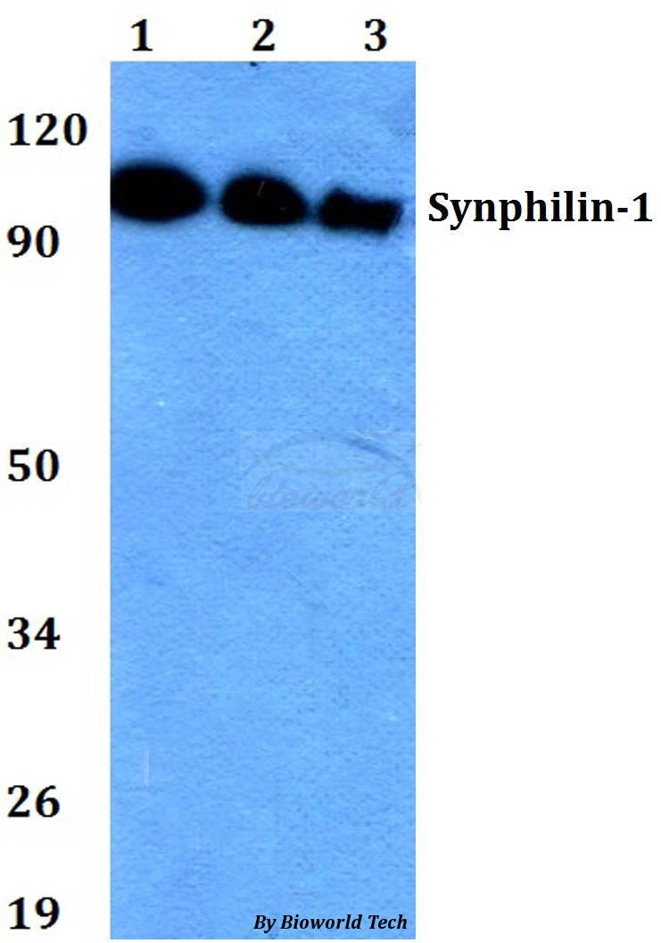 Western blot (WB) analysis of Synphilin-1 (R846) pAb at 1:500 dilution Lane1:HEK293T whole cell lysate Lane2:Raw264.7 whole cell lysate Lane3:H9C2 whole cell lysate