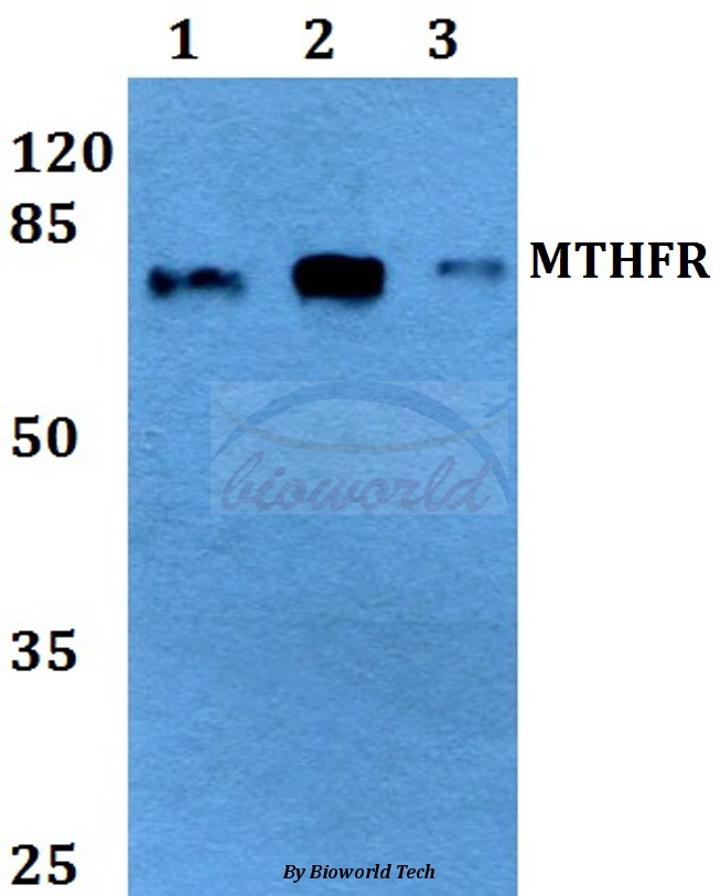 Western blot (WB) analysis of MTHFR (R363) pAb at 1:500 dilution Lane1:HEK293A whole cell lysate Lane2:Raw264.7 whole cell lysate Lane3:PC12 whole cell lysate