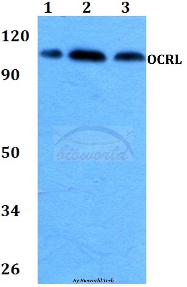 Western blot (WB) analysis of OCRL (Q199) pAb at 1:500 dilution Lane1:HEK293T whole cell lysate Lane2:Raw264.7 whole cell lysate Lane3:H9C2 whole cell lysate