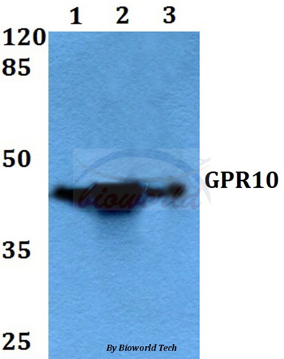 Western blot (WB) analysis of GPR10 (Q223) pAb at 1:500 dilution Lane1:HEK293T whole cell lysate Lane2:Hela whole cell lysate Lane3:Rat brain tissue lysate