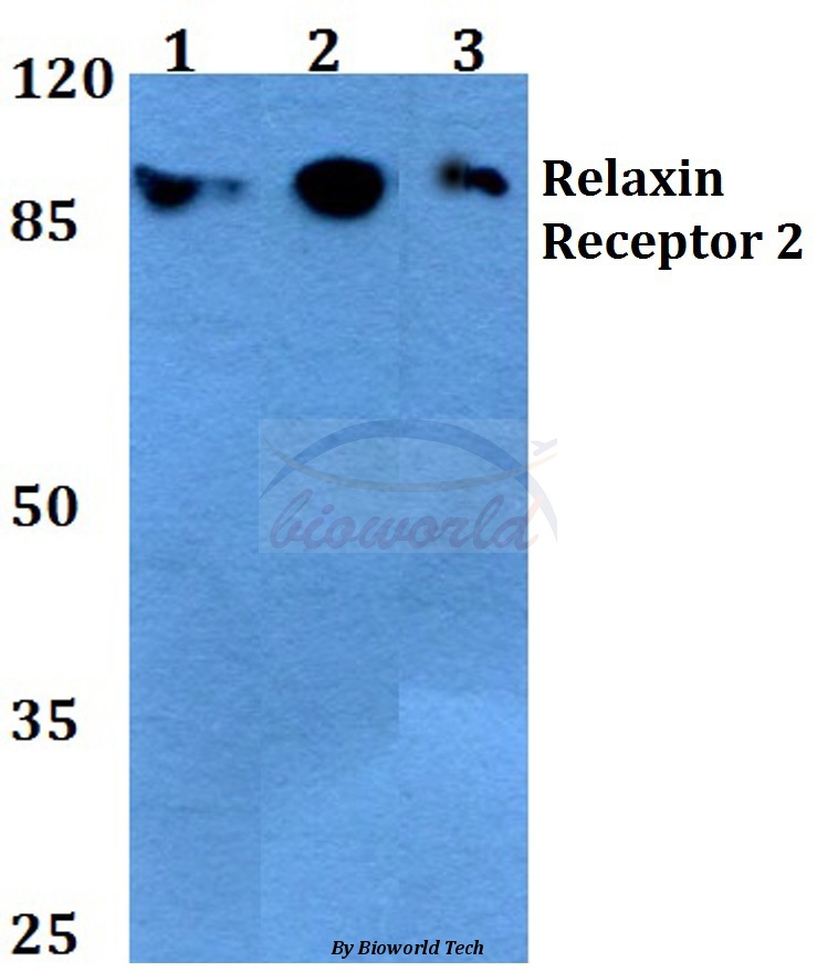 Western blot (WB) analysis of Relaxin Receptor 2 (L152) pAb at 1:500 dilution Lane1:HEK293T whole cell lysate Lane2:Raw264.7 whole cell lysate Lane3:H9C2 whole cell lysate