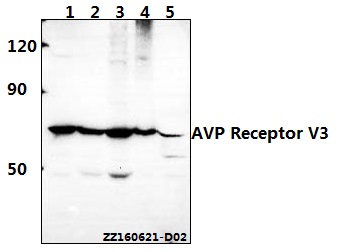 Western blot (WB) analysis of AVP Receptor V3 (D314) pAb at 1:500 dilution Lane1:L02 whole cell lysate(40ug) Lane2:HEK293T whole cell lysate(40ug) Lane3:Hela whole cell lysate(40ug) Lane4:PC12 whole cell lysate(40ug) Lane5:BV2 whole cell lysate(40ug)