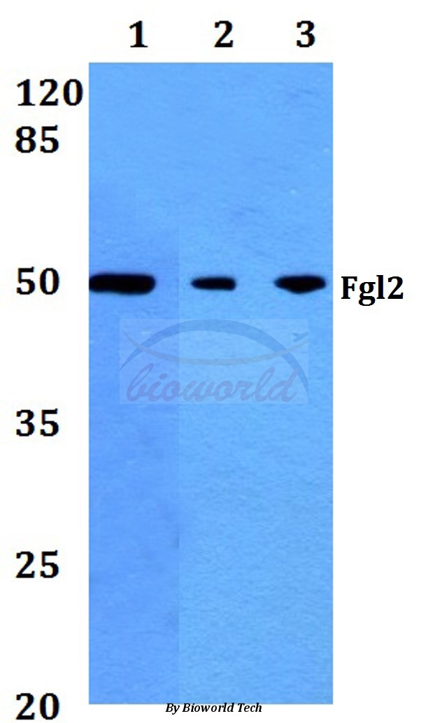 Western blot (WB) analysis of Fgl2 (V38) pAb at 1:500 dilution Lane1:A549 whole cell lysate Lane2:Mouse heart tissue lysate Lane3:Rat heart tissue lysate