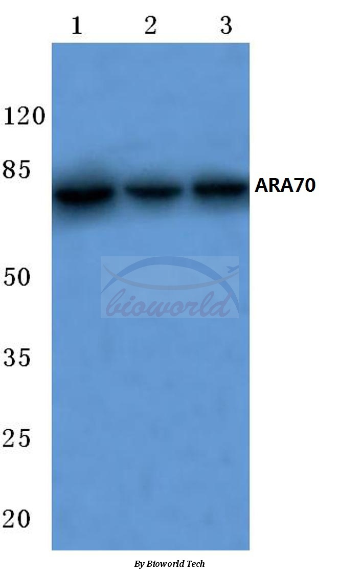 Western blot (WB) analysis of ARA70 (L379) pAb at 1:500 dilution Lane1:MCF-7 cell lysate Lane2:Mouse liver tissue lysate Lane3:Rat lung tissue lysate