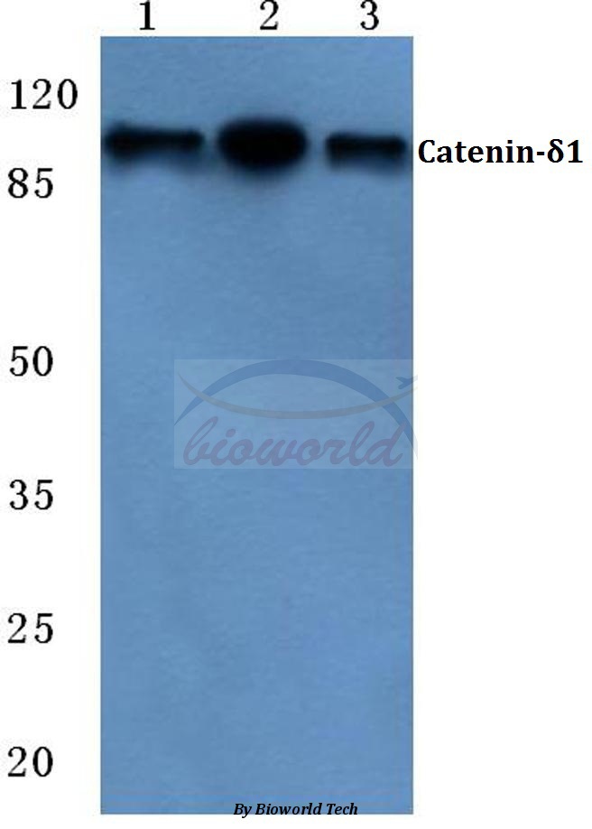 Western blot (WB) analysis of Catenin-δ1 (G224) pAb at 1:500 dilution Lane1:HEK293T cell lysate Lane2:Mouse liver tissue lysate Lane3:Rat liver tissue lysate